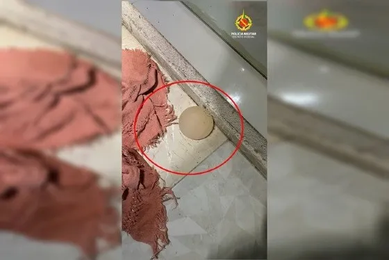 MULHER TEM SILICONE TIRADO COM FACA DE COZINHA APÓS BRIGAR COM O MARIDO