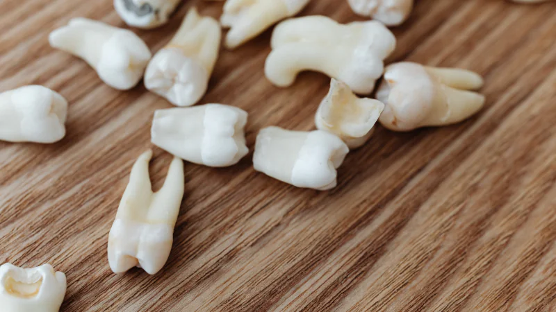 ADEUS DENTADURA, CIENTISTAS CULTIVAM DENTES EM LABORATÓRIO E TESTAM DROGA PARA REGENERAÇÃO