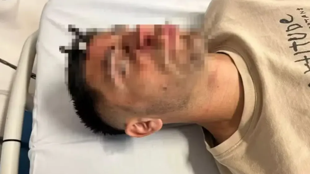 JOGADOR FICA COM A CHAVE DE CARRO CRAVADA NA TESTA APÓS BRIGA EM ESTÁDIO